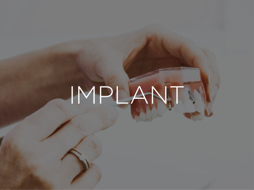 Implant Dentistry