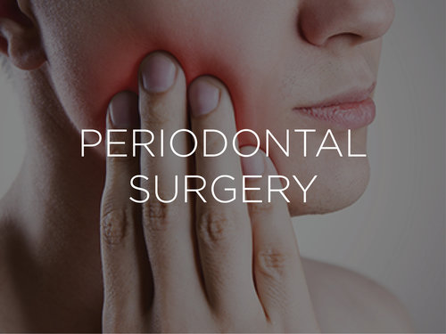 Periodontal-Surgery-212-Smiling