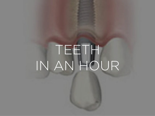 teeth in an hour nyc