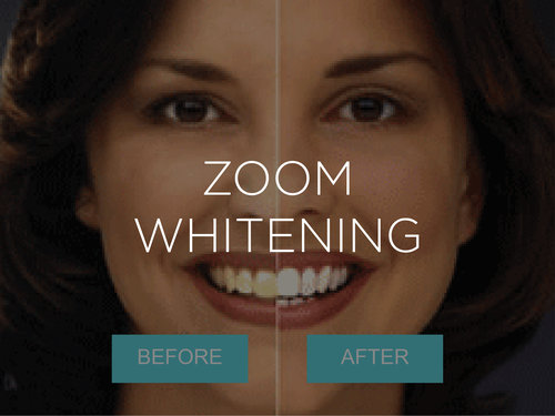 Zoom Teeth Whitening