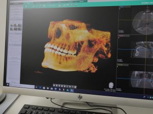 212 Smiling 3D Dental Imaging and Xrays