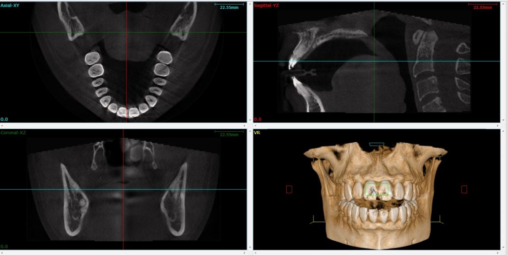 3D Dental Imaging General Dentistry 212 Smiling