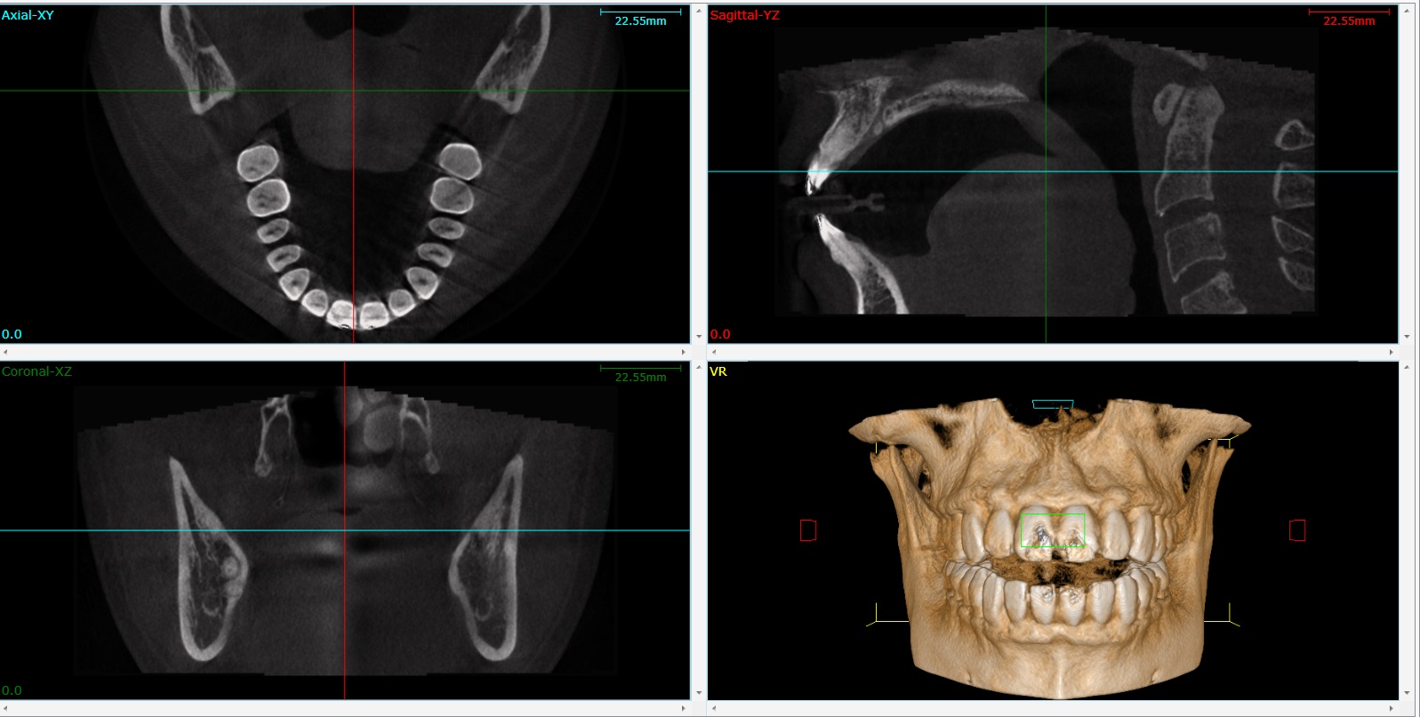 3D Dental Imaging General Dentistry 212 Smiling