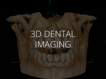 3D Dental Imaging Manhattan