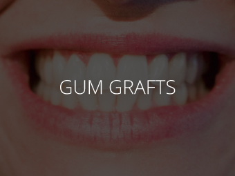 Gum Grafts NYC