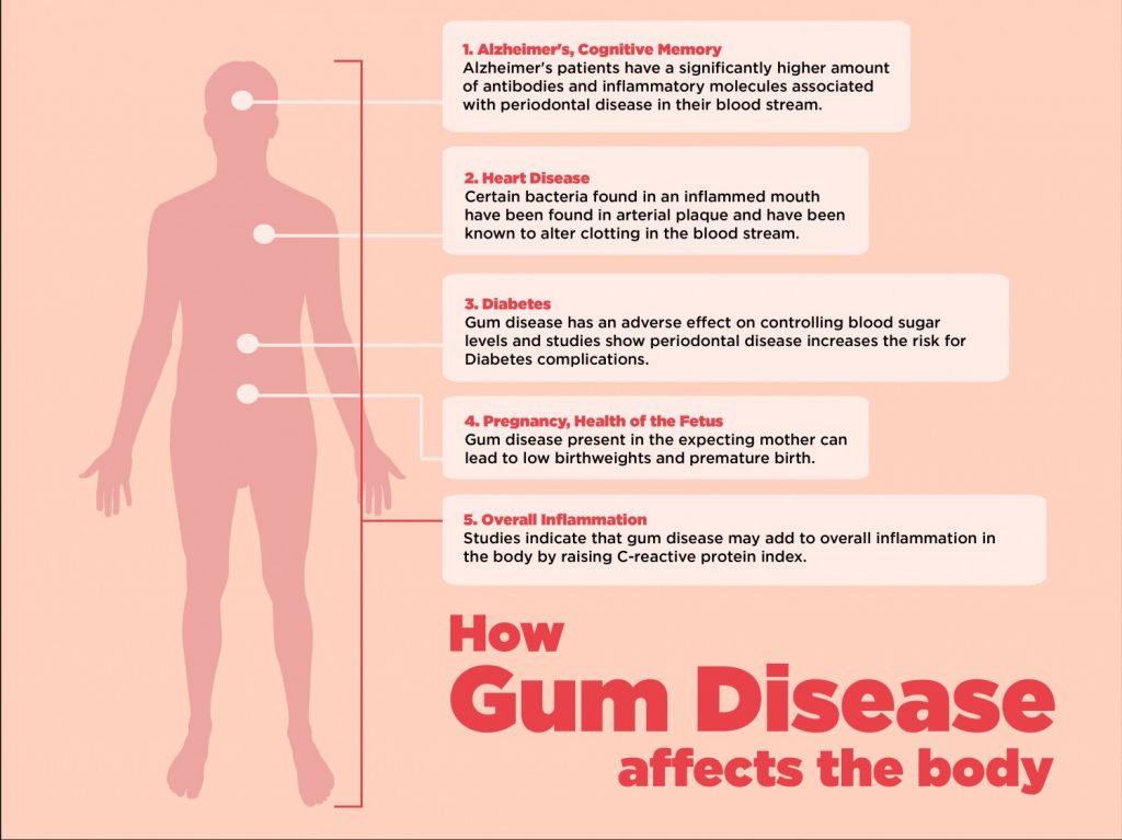 Gum Disease and it Effects