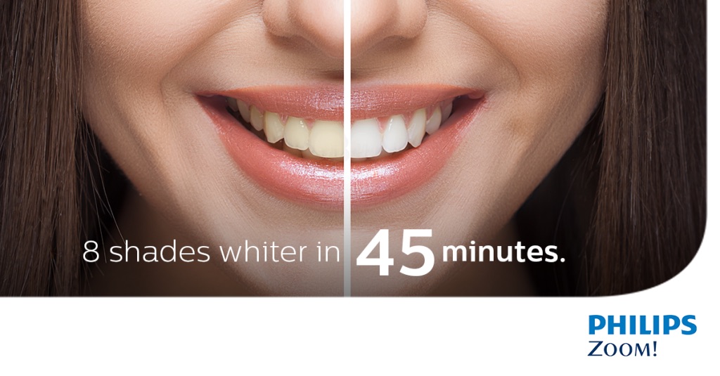 Zoom Teeth Whitening Cosmetic Dentistry 212 Smiling